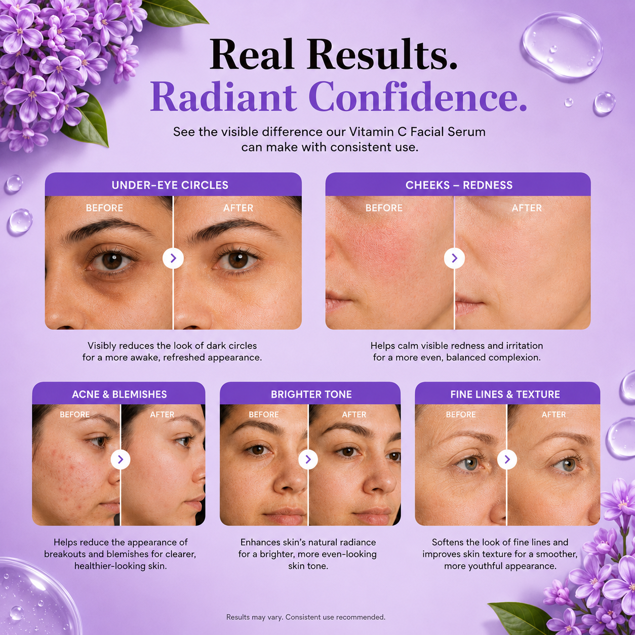 Aura Life Vitamin C Retional Serum+ with Kojic Acid, Niacinamide, Hyaluronic Acid & Vitamin E