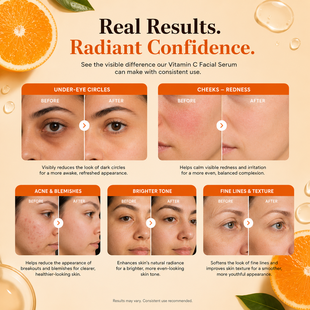 AuraLife Vitamin C Face Serum with Hyaluronic Acid, Vitamin E & Aloe Vera – Brightening Serum for Dark Spots